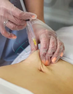 Are-Lipo-Injections-Effective